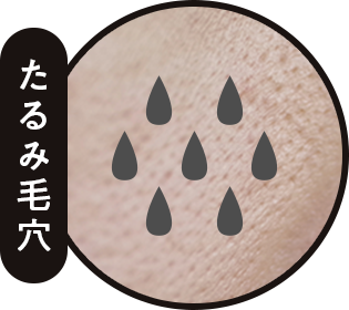 たるみ毛穴