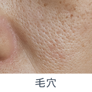 毛穴