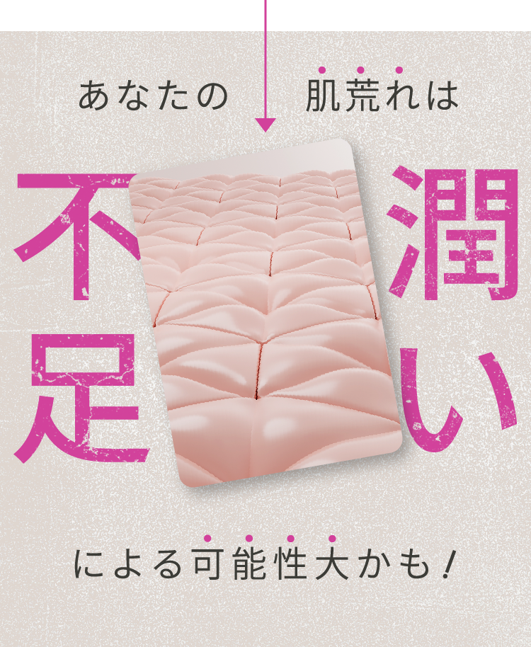 あなたの肌荒れは潤い不足